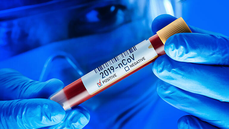 Chinese Corona Virus Blood Test Concept
